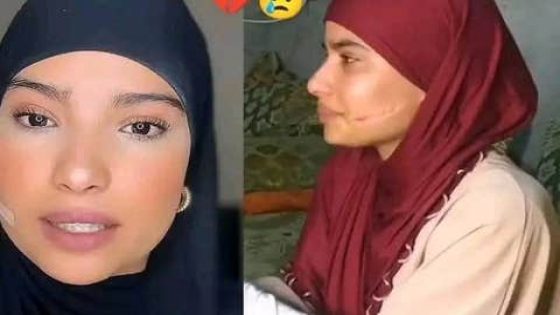 أمن مراكش يوقف المعتدية على الشابة “سلمى”